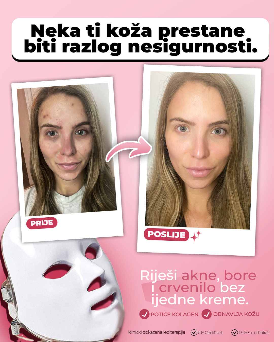 Lunova™  Glow Mask