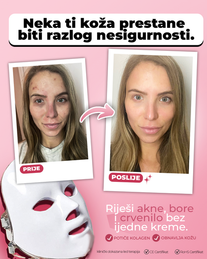 Lunova™  Glow Mask